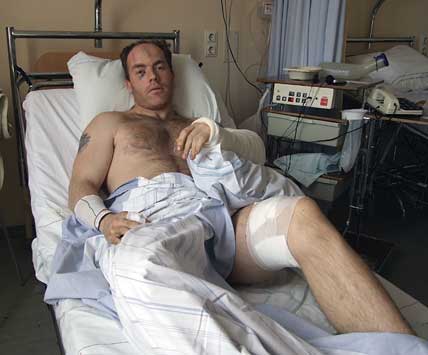 Johnny Smedberg på sjukhuset efter björnattacken, som gjorde att han var nära att förlora sin arm.