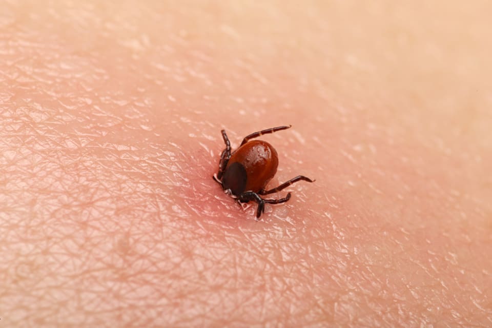 Bästa tipset för att slippa babesia är att kontrollera så att man inte har några fästingar på sig när man har varit ute i naturen.