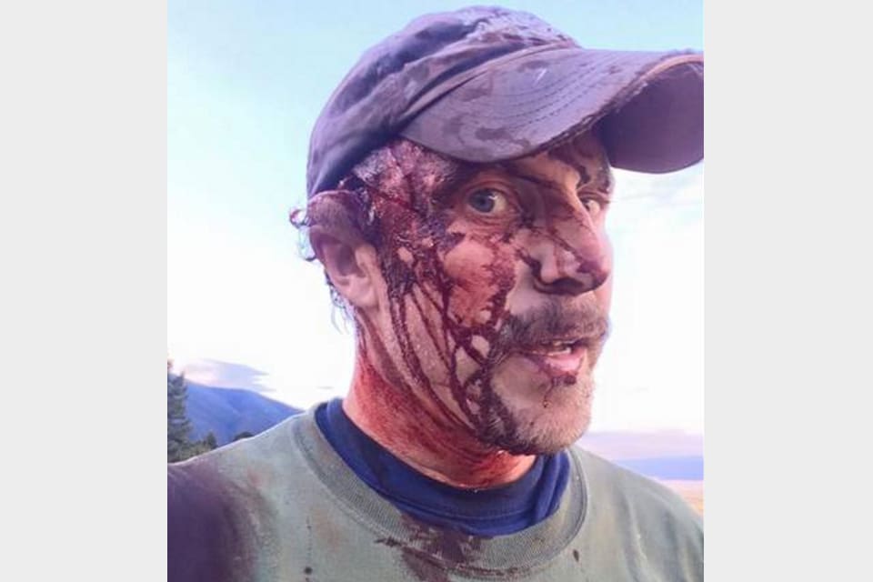 Efter att ha attackerats två gånger av samma grizzlyhona filmade Todd Orr sig själv innan han körde till sjukhus för vård. Han klarade sig med flertalet bitskador.